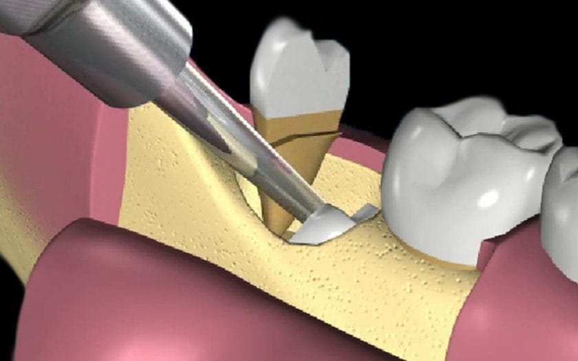 Chirurgia Orale San Giorgio a Cremano