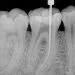 endodonzia san giorgio a cremano
