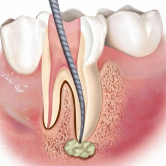 Endodonzia