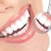 Igiene Dentale san giorgio a cremano