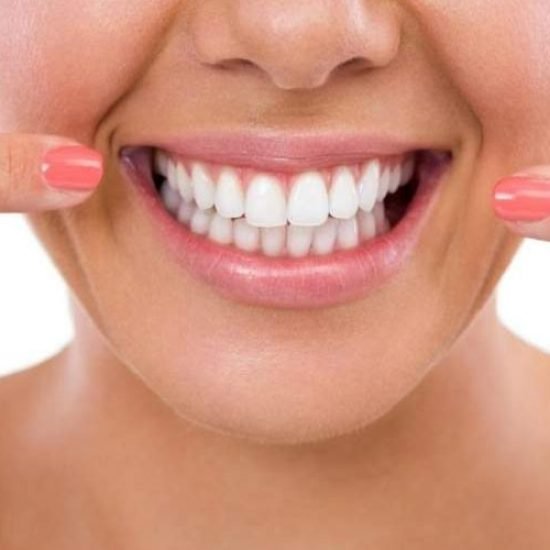 Sbiancamento Dentale Professionale